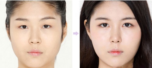 sua mui bang sun tu than dep